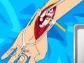 Trò chơi Arm surgery 2