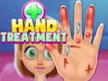 Trò chơi Hand Treatment