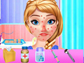 Trò chơi Anna Spring Allergy Treatment