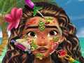Trò chơi Moana Skin Doctor